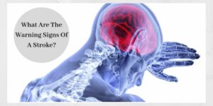 What Are The Warning Signs Of A Stroke - Graphic