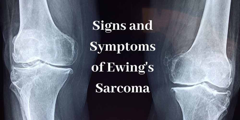 Symptoms Of Ewing's Sarcoma