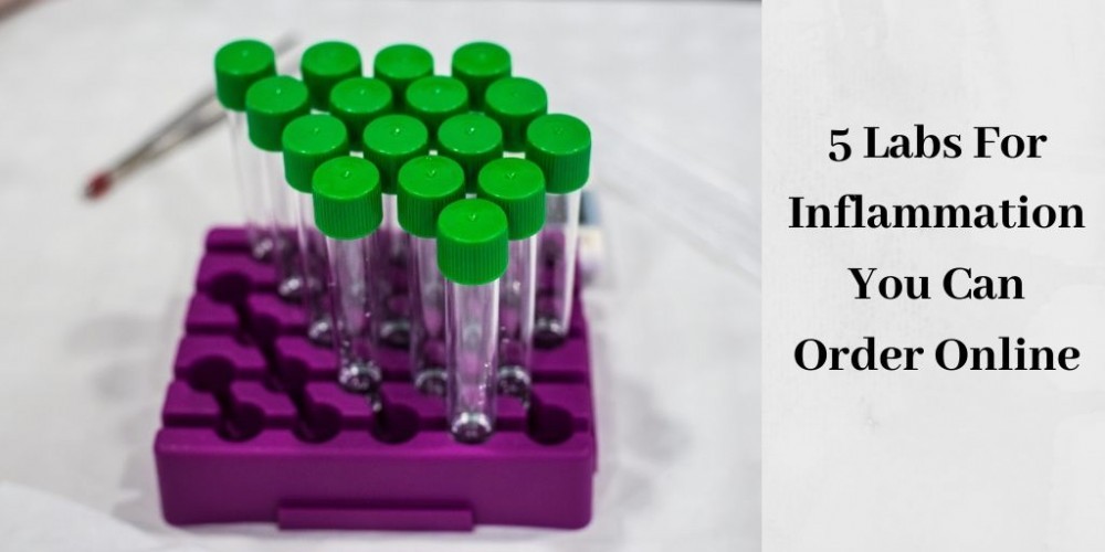 Labs For Inflammation - Lab Testing Vials